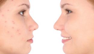 Depositphotos_38382895_xl 2015