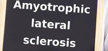 Esclerosis lateral