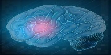 ThThaccidente cerebrovascular