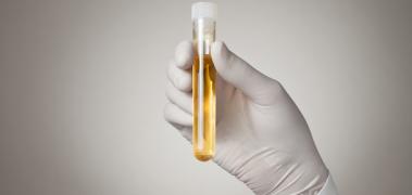 analisis orina