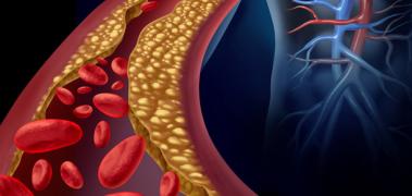 arteria