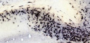 celula inmune