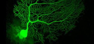 celulacerebral