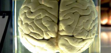 cerebro bote