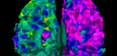 cerebro color