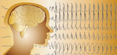cerebro epilepsia