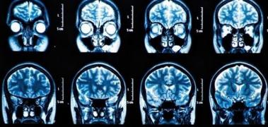 cerebro imagen