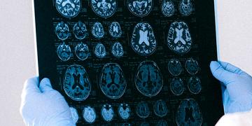 cerebro medicina doctor 0001