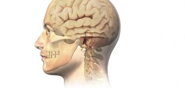 craneo cerebro