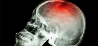 craneo radiografia