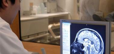 diagnostico alzheimer