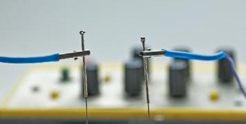 electroacupuntura