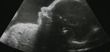 Congreso Virtual Internacional de Psiquiatría, Psicología y Salud Mental (Interpsiquis)