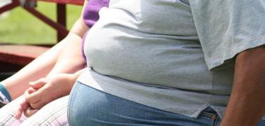 hombre obeso barrgia