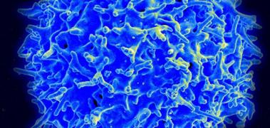 inflammatory dysregulation