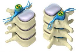 medula1