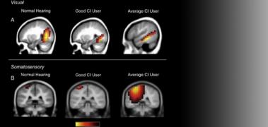 neuroimg