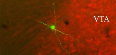 neurona dopaminérgica