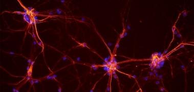 neuronas motoras
