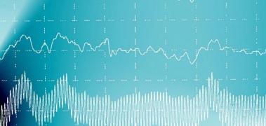 ondas cerebrales epilepsia