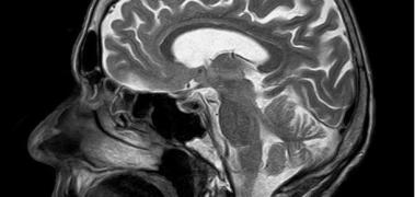 silueta cerebro cabeza