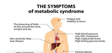 sindrome metabolico