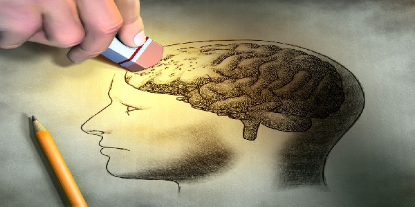 Un estudio descifra las conexiones cerebrales entre la ELA y la demencia frontotemporal